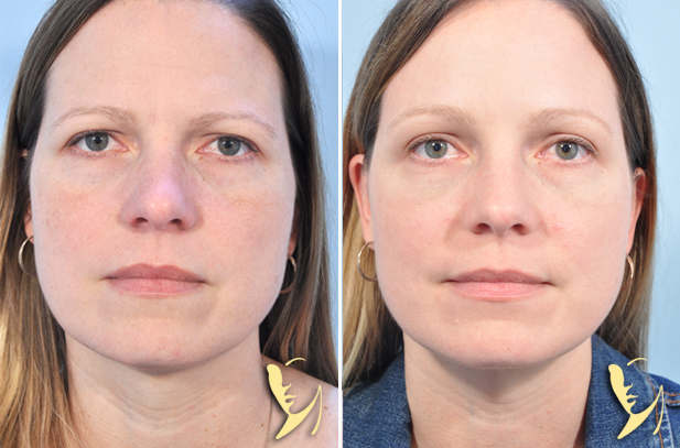 Dr. Victoria Givens  Blog | Cosmetic Surgery vs. Non-Surgical Enhancements: Which Is Right for You?